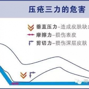 褥疮的预防和治疗
