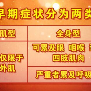 北京卫视20160929《养生堂》、重症肌无力、睁不开眼、呼吸衰竭、脑梗