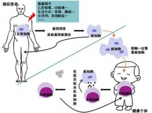 癌症可能存在传染性