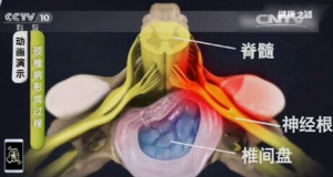 《健康之路》20161024：长期低头对颈椎的危害、颈椎保健操