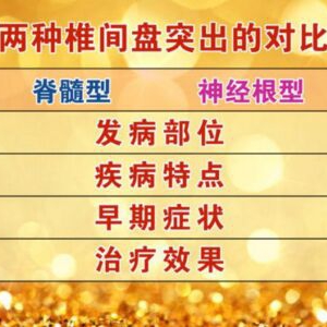 北京卫视20161028《养生堂》脊髓型椎间盘突出、神经根型椎间盘突出、酸麻胀痛、毛巾操