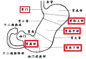 早期胃癌难察觉，到底为什么？