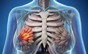 治疗乳腺癌为何要内分泌治疗？