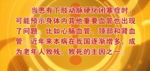 北京卫视20161124《养生堂》《餐桌上的血管“清道夫”》动脉粥样硬化、腿凉、腿麻、腿疼