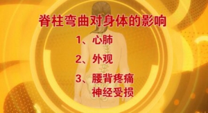 北京卫视20161130《养生堂》《南北名家话健康2-脊柱侧弯》