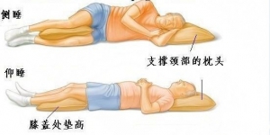 卧床休息能治腰椎间盘突出吗？
