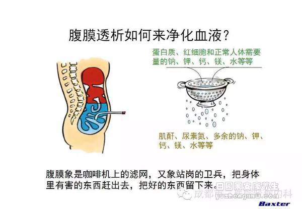 科普：血液透析和腹膜透析