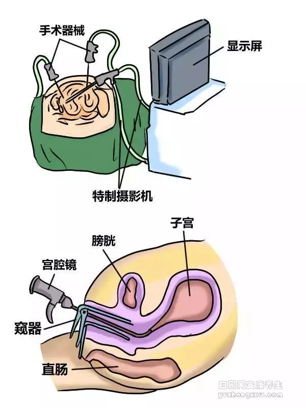 妇科体检项目，该怎么选？