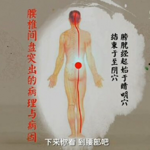 《健康之路》20161225《调脊柱保健康（下）》腿麻腿痛、腰突牵引、脊柱锻炼保健操