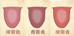 四大舌色各自代表的健康内涵