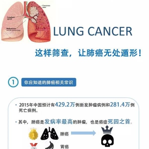 肺癌筛查的相关知识