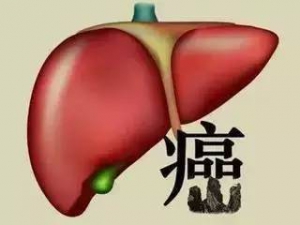 早期肝癌的九大蛛丝马迹