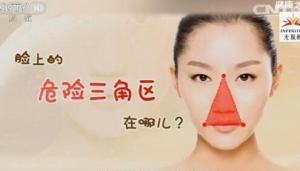 《健康之路》20170124何焱琳《皮肤问题你治对了吗？》