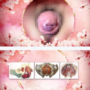 《养生堂》20170210朱兰《守护女性的健康“底盘”》女性盆底功能障碍性疾病