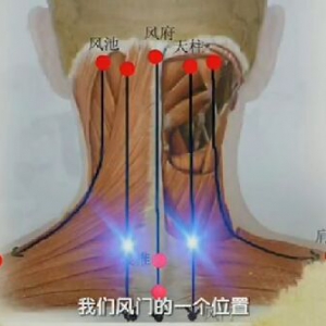 《健康之路》20170211王莹莹《手到病除（中）》刮痧、颈痛、腰痛、腿麻