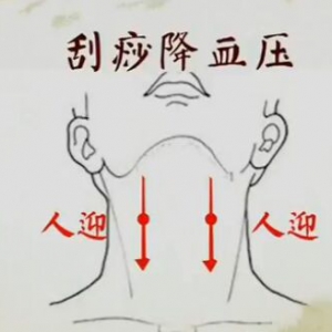 《健康之路》20170212王莹莹《手到病除（下）》刮痧减肥