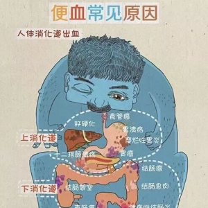 便血常见原因