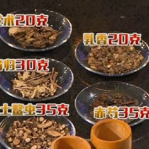 《健康之路》20170226阮志忠《中医帮你腿脚轻松（下）》腿沉、腿冷、暖腿操