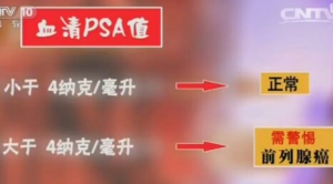 《健康之路》20170324宋刚《前列腺癌早发现》雄性激素与前列腺癌的关系