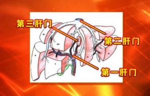 《养生堂》20170419吴健雄《“揪出”癌症背后的罪魁祸首》肝癌的诱因与预防