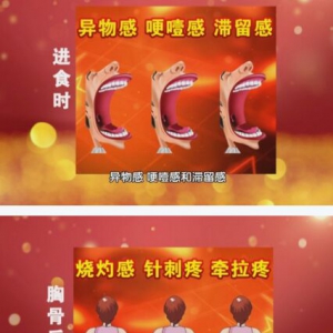 《养生堂》20170420《隐匿的癌症真相》食管癌的诱因与预防