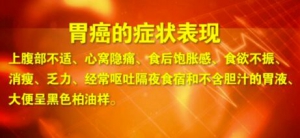 《养生堂》20170422《小病毒中的大隐患》胃癌与EBV病毒