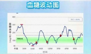 《健康之路》20170611《糖尿病用药大拷问》（下）糖尿病用药问答