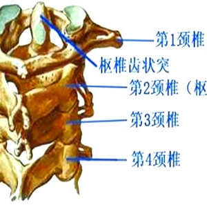 生活中该怎么预防寰枢关节半脱位？