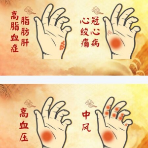 《养生堂》20170624韩学杰《第六脏中的长寿经—1》手诊面诊识健康