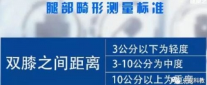 《健康之路》20170903郭晓忠《关节健康你做主（下）》膝关节病变