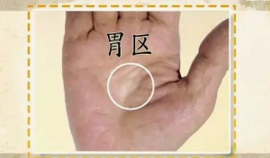 《健康之路》20170920《手上的健康密码（下）》看手辩健康