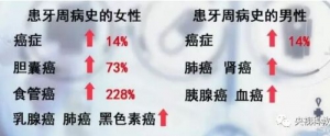 《健康之路》20170921栾庆先《牙好才长寿》牙周炎与哪些疾病有关？