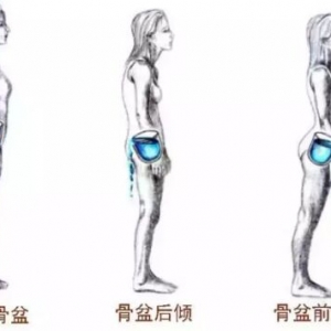 《健康之路》20171029骨盆不正的健康隐患、骨盆矫正的步骤