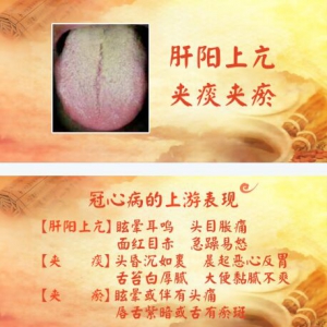 《养生堂》20171110《一药三用 巧通心络》清肝化痰通脉饮