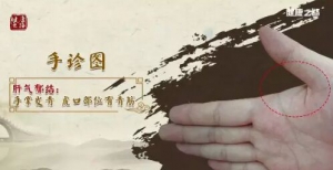 《健康之路》20180316《百年经方巧调肝》沈氏女科、小柴胡汤、珍决汤、柔肝散