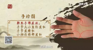 《健康之路》20180318《百年经方巧养肺》肺气亏虚、肺阴亏虚
