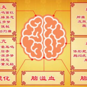 《养生堂》20180507脑溢血、脑缺血、肝阳上亢、肝火上炎、痰湿、瘀血