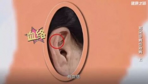 《健康之路》20180514《耳朵诊病也治病》（上）