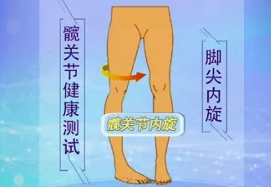 髋关节健康测试