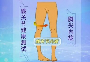 《健康之路》20180706骨坏死、股骨头坏死、滥用激素、髋关节置换