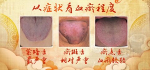 《养生堂》20180908《观舌象 辨健康》活血安神羹、萝卜饮荷叶茶、益气养血饮