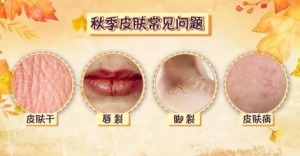 《健康之路》20181015皮肤干燥、皮肤瘙痒、止痒方、止痒药膏、止痒误区