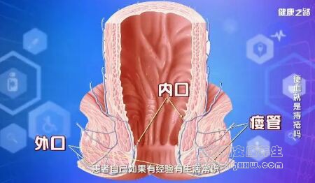 《健康之路》20181020肠癌、肛瘘、溃疡性结肠炎、痔疮、肠息肉