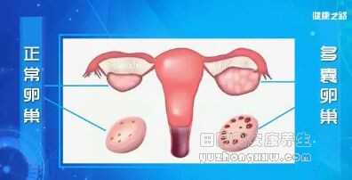 《健康之路》20181028《谁碍了你的生育力》（下）受孕隐患