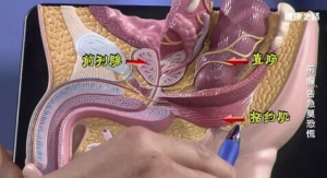 《健康之路》20181114王建文、PSA升高、泌尿系炎症、前列腺炎、前列腺癌