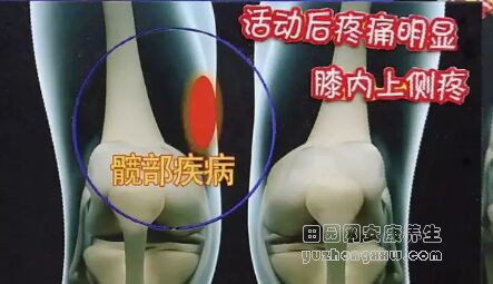 《健康之路》20181130类风湿性关节炎、痛风性滑膜炎、骶髂关节紊乱、髋部疾病