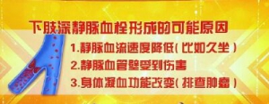 《养生堂》20190308深静脉血栓,腿肿,静脉血栓,动脉血栓