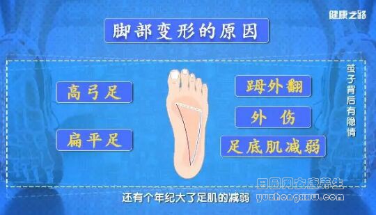 脚部变形的原因