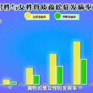 《健康之路》20190706补钙的误区，如何正确、有效补钙？