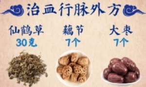 《养生堂》曹炜讲血瘀,活血通络,痹证,治血行脉处方